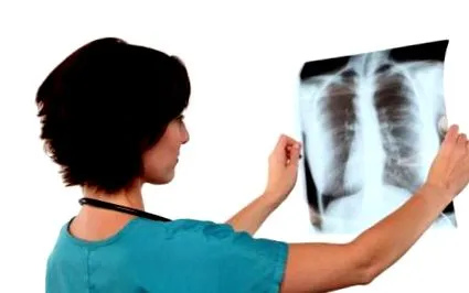 pulmonară
