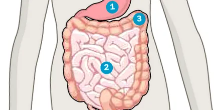 infecții gastrointestinale