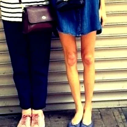 anorexia nervosa