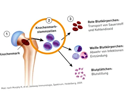 myelofibrosis