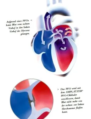 foramen foramen