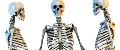 osteochondrosis