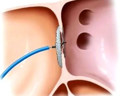 cardiologie