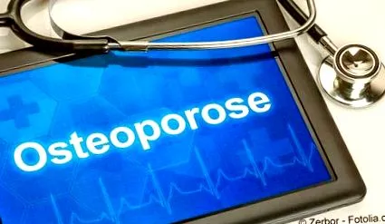 osteoporosis