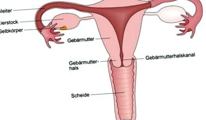 ovarian polichistic