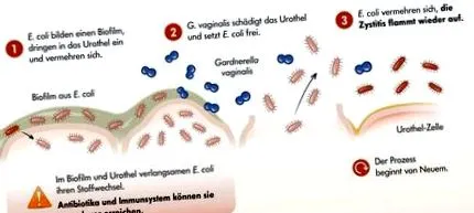 Gardnerella vaginalis