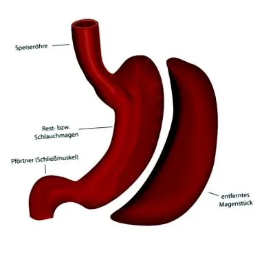efecte riscuri