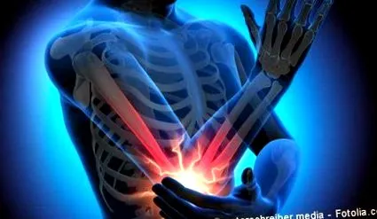 bursitis