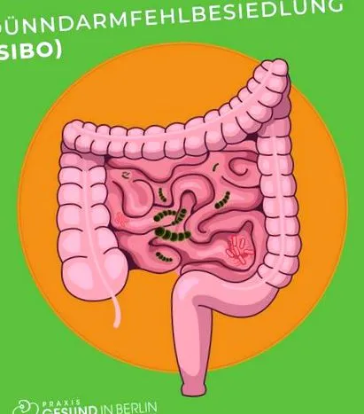 intestinului