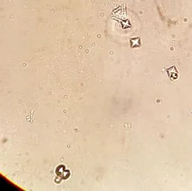 vizelet