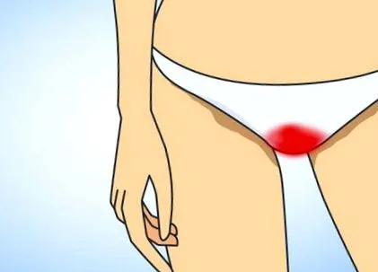 gonorrhoea gonorrhoea