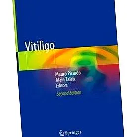 gratuită vitiligo