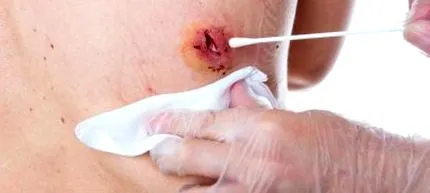 preveni