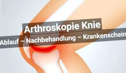 artroscopia