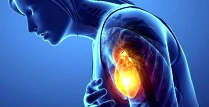 angina pectoris