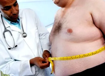 obezitatea obeze