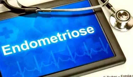 endometrioză simptome