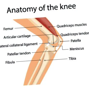 kneecap osteoarthritis