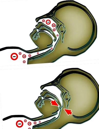 pulmonar pulmonar