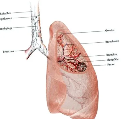 oncologie