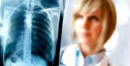 pneumonia