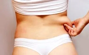 sculpsure
