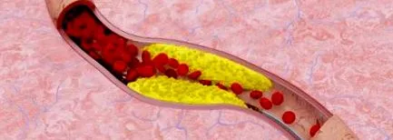 lipid anyagcsere