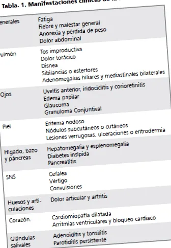 szarkoidózis