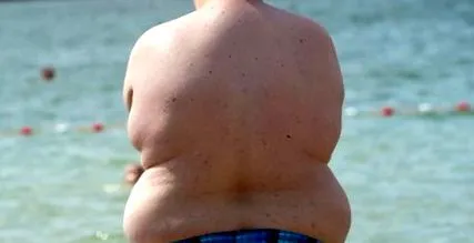 obezitatea
