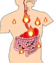 terapeutici