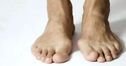 lábfájdalmakban