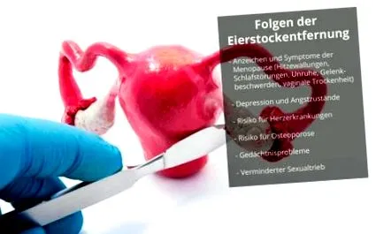 petevezeték petevezeték