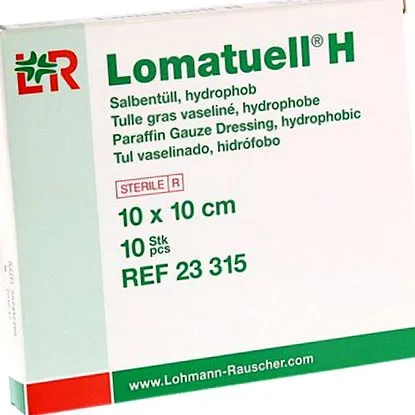 lomatuell tapasztalat