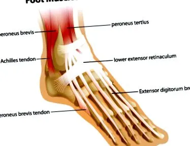 синдром