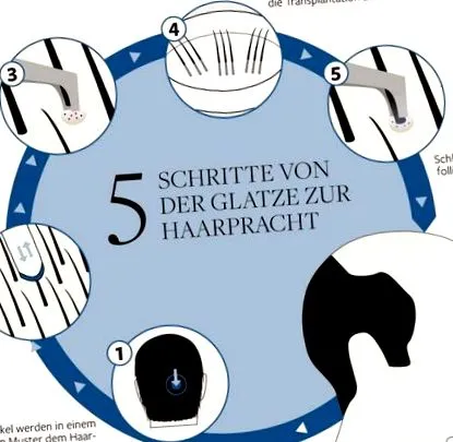 părului welt