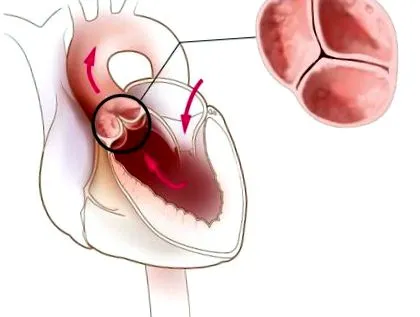 cardiace cardiace