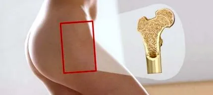 зглобот колкот исто така
