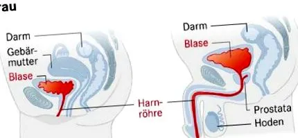 hrenentz urethritis