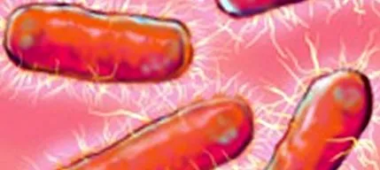 sepsis