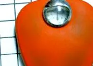 anorexia