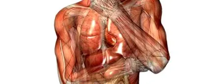 paraplegia esetén