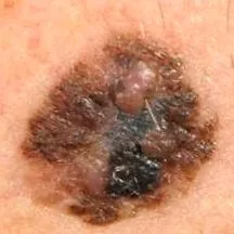 dermatologiei dermatologiei