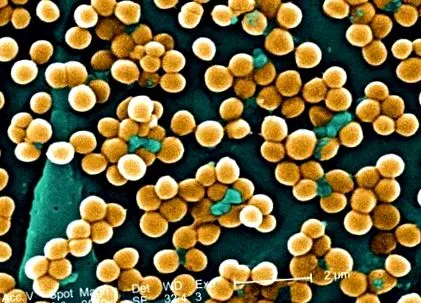 MRSA може
