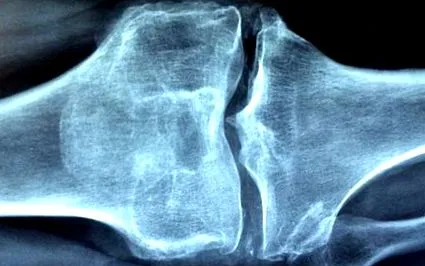 durerea puterea