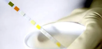 proteinuria