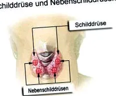 pajzsmirigy autoimmun