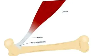 ruptura