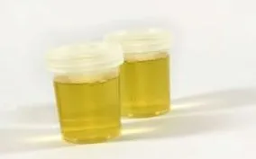 vérkép