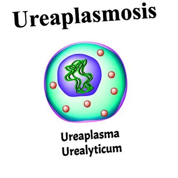 ureaplasma