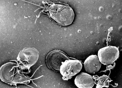 giardia